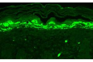 Immunohistochemistry of Mouse Anti-SHANK1 Antibody. (SHANK1 anticorps  (Internal Region))