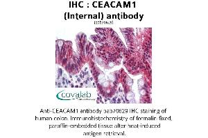 Image no. 1 for anti-Carcinoembryonic Antigen-Related Cell Adhesion Molecule 1 (CEACAM1) (Internal Region) antibody (ABIN1732947) (CEACAM1 anticorps  (Internal Region))