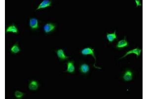 Immunofluorescence staining of A549 cells with ABIN7151029 at 1:33, counter-stained with DAPI. (HECTD3 anticorps  (AA 682-785))