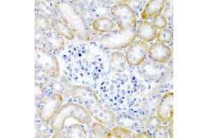 Immunohistochemistry of paraffin-embedded rat kidney using RLN2 antibody (ABIN6129627, ABIN6146976, ABIN6146977 and ABIN6222724) at dilution of 1:200 (40x lens). (Relaxin 2 anticorps  (AA 25-185))