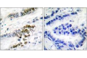 Immunohistochemistry (IHC) image for anti-Excision Repair Cross Complementing Polypeptide-1 (ERCC1) (AA 141-190) antibody (ABIN2889192) (ERCC1 anticorps  (AA 141-190))