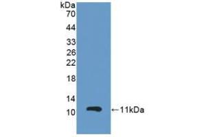 Figure. (GPX3 anticorps  (AA 3-72))