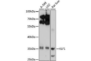 Western blot analysis of extracts of various cell lines, using KLF1 antibody (ABIN6134663, ABIN6142905, ABIN6142906 and ABIN6214882) at 1:1000 dilution. (KLF1 anticorps  (AA 1-100))