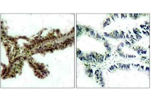 Image no. 1 for anti-V-Akt Murine Thymoma Viral Oncogene Homolog 1 (AKT1) (pThr308) antibody (ABIN196711) (AKT1 anticorps  (pThr308))