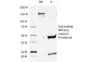 SDS-PAGE Analysis Purified CD44v4 Mouse Monoclonal Antibody (CD44v4/1219). (CD44 anticorps)