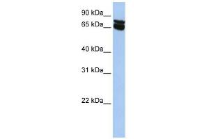 B4GALNT1 antibody used at 1 ug/ml to detect target protein. (B4GALNT1 anticorps  (N-Term))