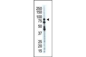 Western Blotting (WB) image for anti-Salt-Inducible Kinase 1 (SIK1) (C-Term) antibody (ABIN360572) (SIK1 anticorps  (C-Term))