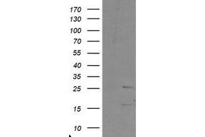 Image no. 1 for anti-PYD and CARD Domain Containing (PYCARD) antibody (ABIN1500519) (PYCARD anticorps)