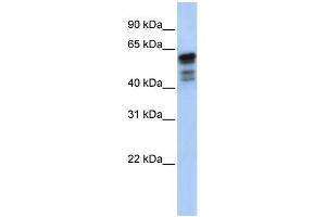 WB Suggested Anti-DES Antibody Titration:  0. (Desmin anticorps  (Middle Region))