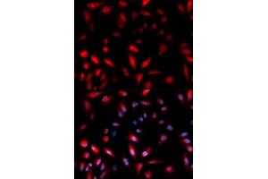 Immunofluorescence analysis of U2OS cell using Phospho-HSPB1-S82 antibody. (HSP27 anticorps  (pSer82))