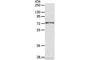 Western blot analysis of PC3 cell, using ADAM10 Polyclonal Antibody at dilution of 1:300 (ADAM10 anticorps)