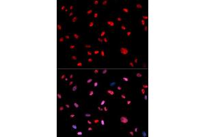 Immunofluorescence (IF) image for anti-Jun Proto-Oncogene (JUN) (pThr239) antibody (ABIN1870293) (C-JUN anticorps  (pThr239))