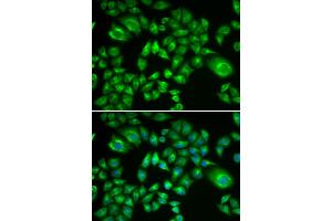 Immunofluorescence analysis of A549 cells using H6PD antibody (ABIN5973840). (Glucose-6-Phosphate Dehydrogenase anticorps)