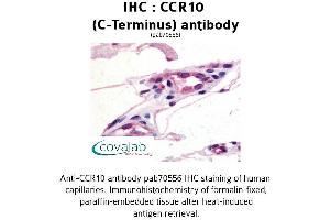 Image no. 1 for anti-Chemokine (C-C Motif) Receptor 10 (CCR10) (C-Term) antibody (ABIN1732758) (CCR10 anticorps  (C-Term))