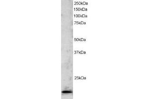 ABIN184823 staining (2µg/ml) of Jurkat lysate (RIPA buffer, 30µg total protein per lane). (TBPL1 anticorps  (C-Term))