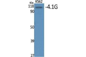 Western Blot (WB) analysis of specific cells using 4. (EPB41L2 anticorps  (Internal Region))