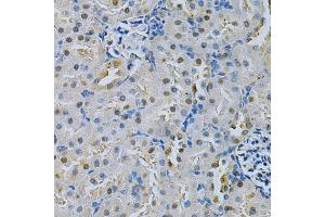 Immunohistochemistry of paraffin-embedded rat kidney using SPHK1 Antibody. (SPHK1 anticorps)