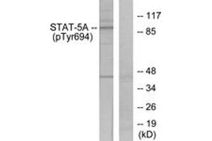 Western blot analysis of extracts from HeLa cells treated with EGF, using STAT5A (Phospho-Tyr694) Antibody. (STAT5A anticorps  (pTyr694))