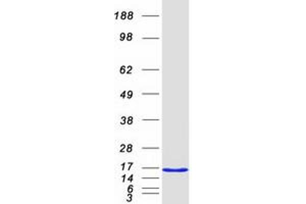 TIMM8A/DDP Protein (Transcript Variant 1) (Myc-DYKDDDDK Tag)