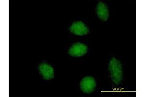Immunofluorescence of purified MaxPab antibody to DNAJB6 on HeLa cell. (DNAJB6 anticorps  (AA 1-326))