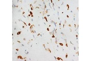 Immunohistochemistry with CBFA1 Polyclonal Antibody (RUNX2 anticorps  (C-Term))