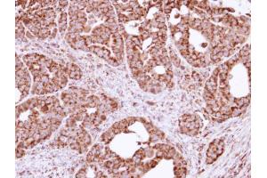 Immunohistochemistry (IHC) image for anti-Fission 1 (FIS1) (full length) antibody (ABIN2856782)