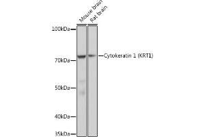 Western blot analysis of extracts of various cell lines, using Cytokeratin 1 (KRT1) (KRT1) Rabbit mAb (ABIN7268085) at 1:1000 dilution. (Cytokeratin 1 anticorps)