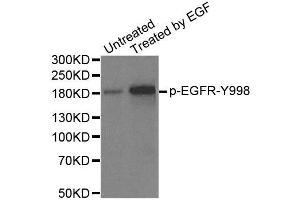Western Blotting (WB) image for anti-Epidermal Growth Factor Receptor (EGFR) (pTyr1172) antibody (ABIN1870117) (EGFR anticorps  (pTyr1172))