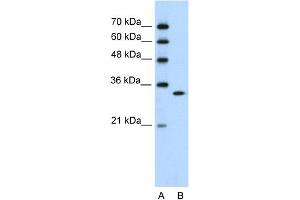 WB Suggested Anti-RNASEH2A Antibody Titration:  0. (RNASEH2A anticorps  (C-Term))