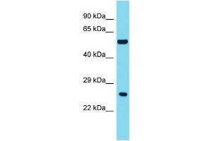 Host: Rabbit Target Name: ANKRD18A Sample Type: Fetal Liver lysates Antibody Dilution: 1. (ANKRD18A anticorps  (C-Term))