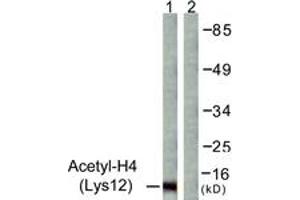 Western blot analysis of extracts from COS7 cells, treated with TSA 400nM 24h, using Histone H4 (Acetyl-Lys12) Antibody. (Histone H4 anticorps  (acLys12))