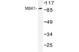 Image no. 1 for anti-Ribosomal Protein S6 Kinase, 90kDa, Polypeptide 5 (RPS6KA5) antibody (ABIN317778) (MSK1 anticorps)