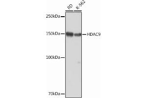 Western blot analysis of extracts of various cell lines, using HD Rabbit mAb (ABIN1680476, ABIN3015870, ABIN3015871 and ABIN7101453) at 1:1000 dilution. (HDAC9 anticorps)
