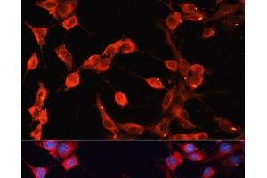 Immunofluorescence analysis of NIH-3T3 cells using ADAMTS13 Polyclonal Antibody at dilution of 1:100 (40x lens). (ADAMTS13 anticorps)