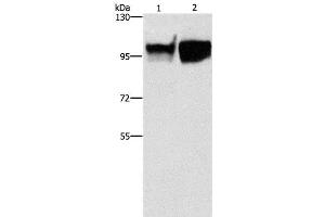 Western Blot analysis of Hela and raji cell using CD54 Polyclonal Antibody at dilution of 1:350 (ICAM1 anticorps)