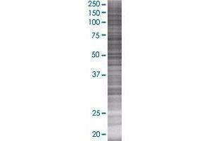 RNF185 transfected lysate. (RNF185 293T Cell Transient Overexpression Lysate(Denatured))