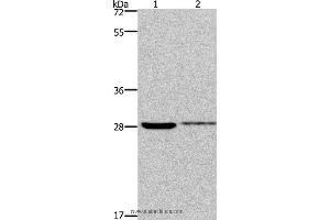 Western blot analysis of 231 and Hela cell, using CDK1 Polyclonal Antibody at dilution of 1:300 (CDK1 anticorps)