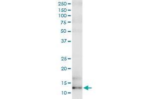 Immunoprecipitation of SAA4 transfected lysate using rabbit polyclonal anti-SAA4 and Protein A Magnetic Bead (SAA4 (Humain) IP-WB Antibody Pair)