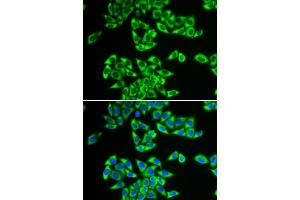 Immunofluorescence analysis of HeLa cells using DDX3X antibody. (DDX3X anticorps)