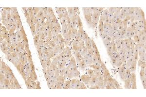 Detection of MYO in Human Cardiac Muscle Tissue using Monoclonal Antibody to Myoglobin (MYO) (Myoglobin anticorps  (AA 1-154))