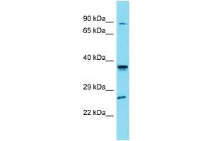 Western Blotting (WB) image for anti-Solute Carrier Family 35, Member G4 (SLC35G4) (N-Term) antibody (ABIN2505580) (SLC35G4 anticorps  (N-Term))