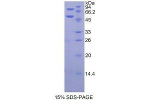 SDS-PAGE analysis of Mouse Protein C Protein. (PROC Protéine)