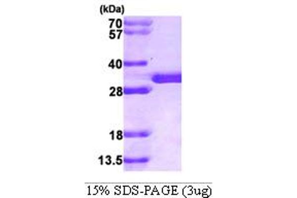 SPR Protein (AA 1-261) (His tag)