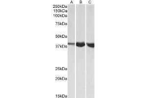 ABIN4902524 (1µg/ml) staining of Human (A), Mouse (B) and Rat (C) Skeletal Muscle lysates (35µg protein in RIPA buffer). (ALDOA anticorps)