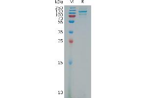 Human Protein, His Tag on SDS-PAGE under reducing condition. (NRP2 Protein (AA 21-864) (His tag))