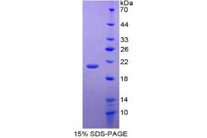 SDS-PAGE analysis of Mouse GDF2 Protein. (GDF2 Protéine)