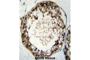 Immunohistochemistry (IHC) image for anti-Testis Specific Serine Kinase 4 (TSSK4) antibody (ABIN2996104) (TSSK4 anticorps)