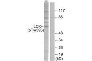 Western Blotting (WB) image for anti-Lymphocyte-Specific Protein tyrosine Kinase (LCK) (pTyr393) antibody (ABIN2888462) (LCK anticorps  (pTyr393))