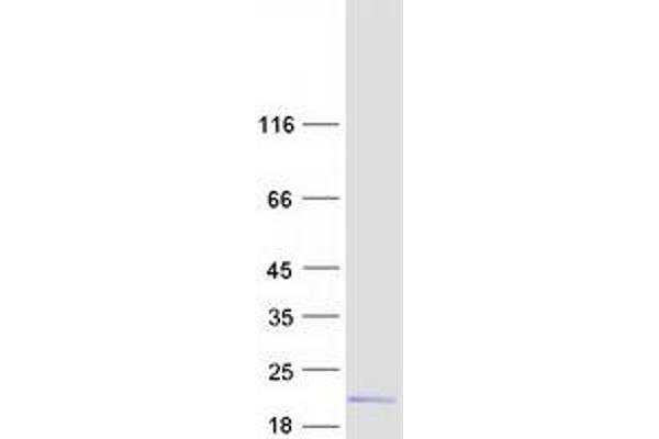 DNAJC24 Protein (Myc-DYKDDDDK Tag)