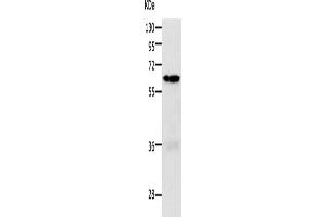 Western Blotting (WB) image for anti-P21-Activated Kinase 1 (PAK1) antibody (ABIN2426800) (PAK1 anticorps)
